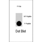 TSC2 (pS1798) Antibody