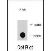 ABL (pY204) Antibody