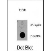 RPS6KA1 (pT359) Antibody