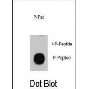 ATM (pS1981) Antibody