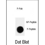 p27Kip1 (pT198) Antibody