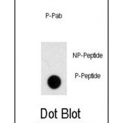NOMO1 (pS1205) Antibody