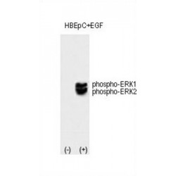 Mitogen-Activated Protein Kinase 1 and 3 Phospho-Thr202/Tyr204 (MAPK1/MAPK3 pT202/pY204) Antibody