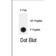 TERT (pY707) Antibody