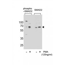 Mothers Against Decapentaplegic Homolog 2 Phospho-Thr220 (SMAD2 pT220) Antibody