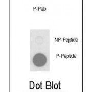 PLB (pT17) Antibody