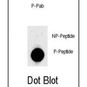 LIN28 (pS134) Antibody