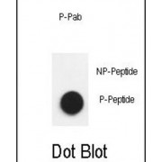 Nephrin (pY1193) Antibody