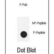 Nephrin (pY1210) Antibody