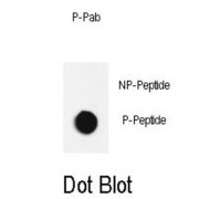 JNK1 (pT183 / Y185) Antibody