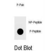 YAP (pS127) Antibody
