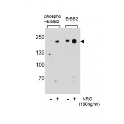 ERBB2 (pS1151) Antibody