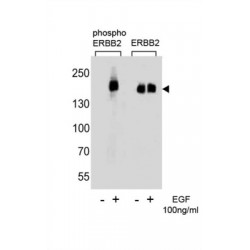 ERBB2 (pY1127) Antibody