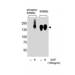 ERBB2 (pY1139) Antibody