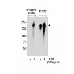 ERBB2 (pY1005) Antibody