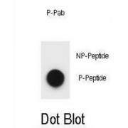 Dot blot analysis of Mouse TSC2 (pS1365) Antibody (0.6 µg/ml) on nitrocellulose membrane. 50 ng of Phospho-peptide per dot were absorbed.
