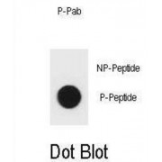 BAD (pS96) Antibody