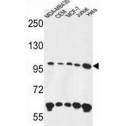 Ankyrin Repeat And FYVE Domain Containing 1 (ANKFY1) Antibody