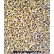 Cysteine-Rich Protein 1 (CRIP1) Antibody