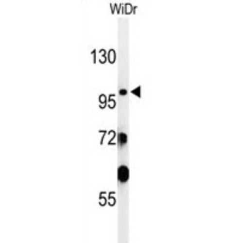Sac2 Antibody Abbexa Ltd