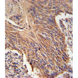 Retinol Dehydrogenase 10 (RDH10) Antibody
