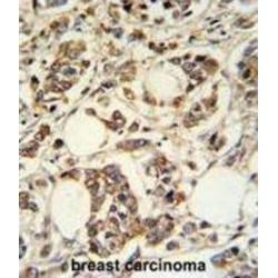 Phosphatidylinositol Glycan, Class M (PIGM) Antibody