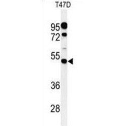 Phosphatidylinositol Glycan, Class M (PIGM) Antibody