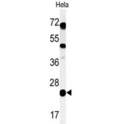Transmembrane Protein C16orf54 (CP054) Antibody