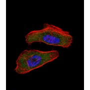 Hypoxia Inducible Factor 1 Alpha (HIF1a) Antibody