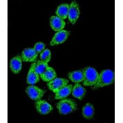abx032307