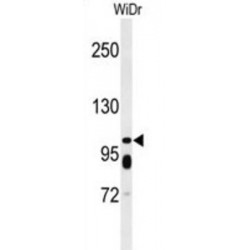 ATP Binding Cassette Subfamily C Member 11 (ABCC11) Antibody