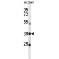 D-Aspartate Oxidase (DDO) Antibody