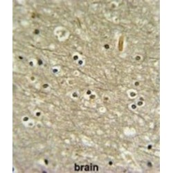 WD Repeat-Containing Protein 82 (WDR82) Antibody