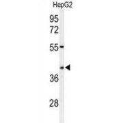 WB analysis of HepG2 cell lysates.