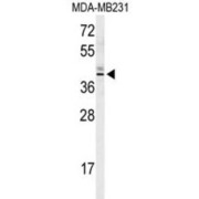 Kelch Domain-Containing Protein 2 (KLDC2) Antibody