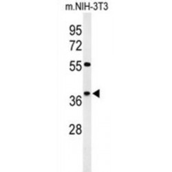 Kelch Domain-Containing Protein 2 (KLDC2) Antibody