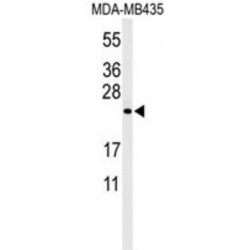 Zinc Finger CCHC Domain-Containing Protein 24 (ZCH24) Antibody
