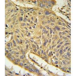 Advanced Glycosylation End Product-Specific Receptor (AGER) Antibody