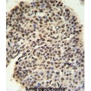 Pre-mRNA-Processing Factor 19 (PRPF19) Antibody