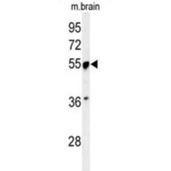 Pre-mRNA-Processing Factor 19 (PRPF19) Antibody