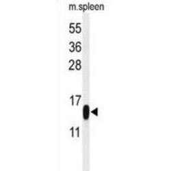 Phospholipase A2 (PLA2G1B) Antibody