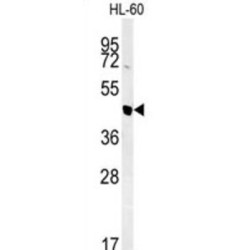 Nuclear Autoantigenic Sperm Protein (NASP) Antibody