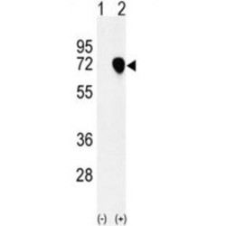Nuclear Autoantigenic Sperm Protein (NASP) Antibody