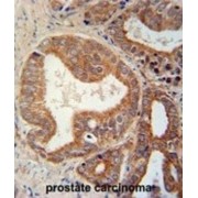 Chondroitin Sulfate N-Acetylgalactosaminyltransferase 1 (CSGALNACT1) Antibody