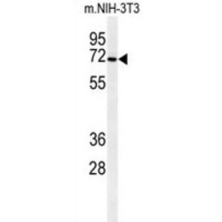 Chondroitin Sulfate N-Acetylgalactosaminyltransferase 1 (CSGALNACT1) Antibody