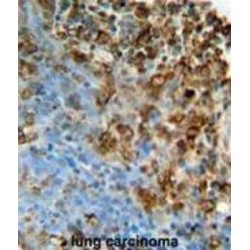 Inosine Triphosphate Pyrophosphatase (ITPA) Antibody