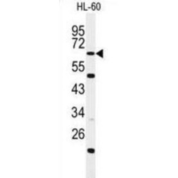 WD And Tetratricopeptide Repeats Protein 1 (WDTC1) Antibody