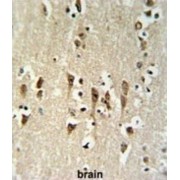 BTB/POZ Domain-Containing Protein KCTD1 (KCTD1) Antibody
