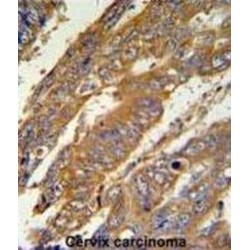 PAN2-PAN3 Deadenylation Complex Subunit PAN3 (PAN3) Antibody