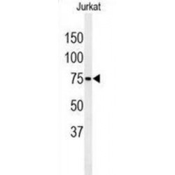 PAN2-PAN3 Deadenylation Complex Subunit PAN3 (PAN3) Antibody